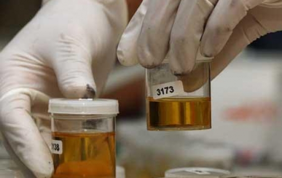 Brigadir Megi Tewas, 86 Polisi Tes Urine